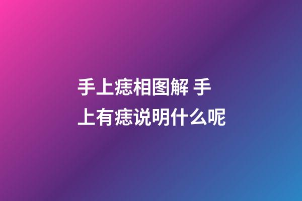 手上痣相图解 手上有痣说明什么呢